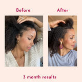 GoGrowCurls Advanced Hair Growth Elixir Subscription